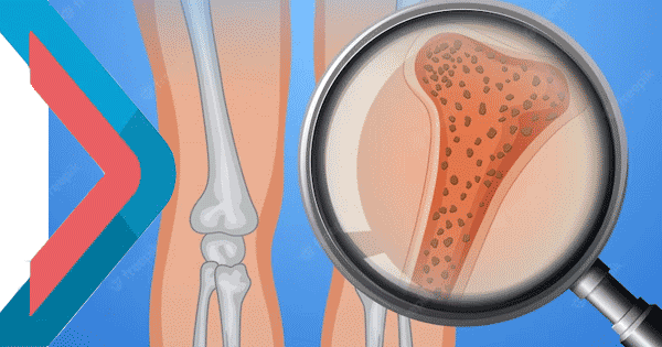 What kind of diseases can a bone profile test detect?